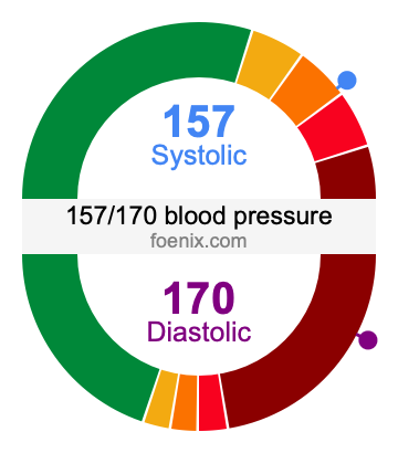 157/170 Blood Pressure Illustration