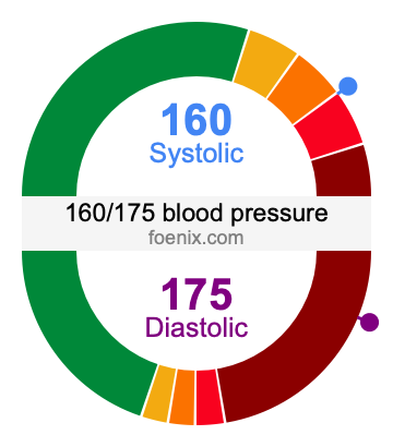 160/175 Blood Pressure Illustration