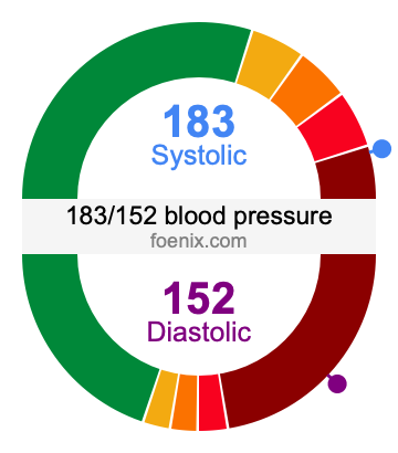 183/152 Blood Pressure Illustration