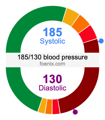 185/130 Blood Pressure Illustration
