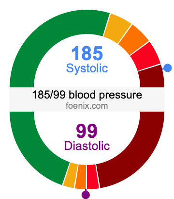 185/99 Blood Pressure Illustration