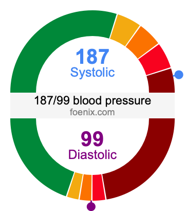 187/99 Blood Pressure Illustration