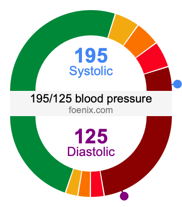 195/125 Blood Pressure Illustration