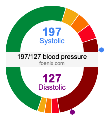 197/127 Blood Pressure Illustration