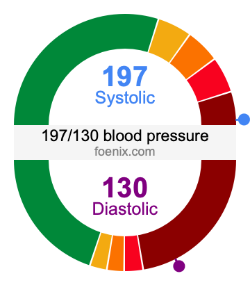 197/130 Blood Pressure Illustration