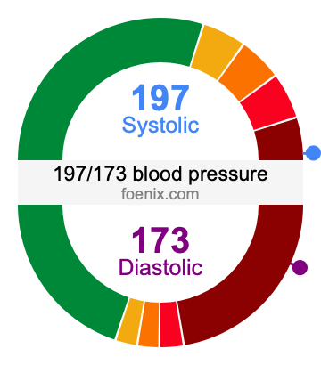 197/173 Blood Pressure Illustration