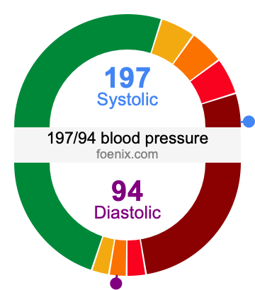 197/94 Blood Pressure Illustration