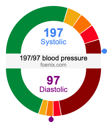 197/97 Blood Pressure Illustration