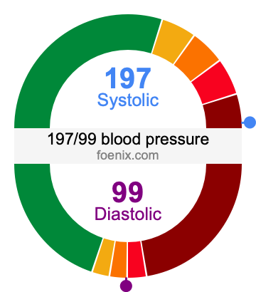 197/99 Blood Pressure Illustration