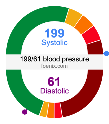 199/61 Blood Pressure Illustration
