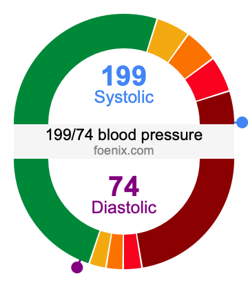 199/74 Blood Pressure Illustration