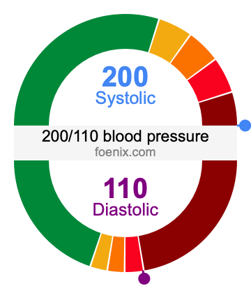200/110 Blood Pressure Illustration
