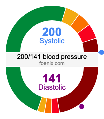 200/141 Blood Pressure Illustration