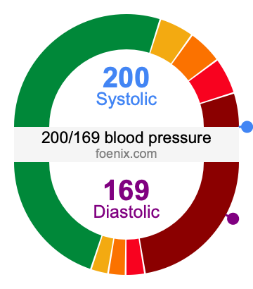 200/169 Blood Pressure Illustration