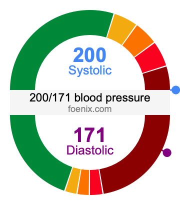 200/171 Blood Pressure Illustration