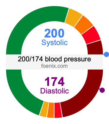 200/174 Blood Pressure Illustration