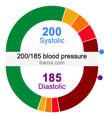 200/185 Blood Pressure Illustration