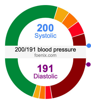 200/191 Blood Pressure Illustration
