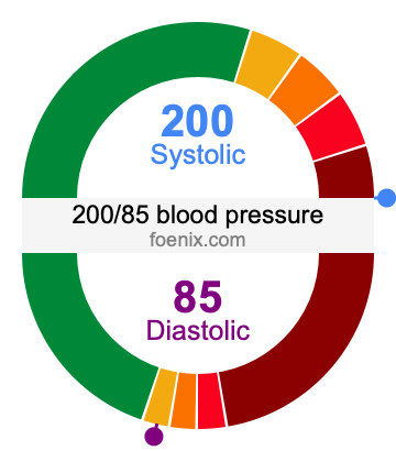 200/85 Blood Pressure Illustration