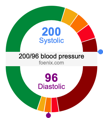 200/96 Blood Pressure Illustration